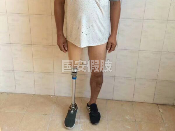 長沙國安假肢康復(fù)用品有限公司,長沙假肢用品,國安假肢康復(fù)用品,假肢矯形器,康復(fù)器材,假肢配件,矯形器支具